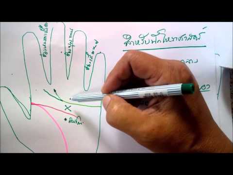 ยาความอ่อนแอชาย สมาชิกก่อนและหลังพลาสติก frenulum