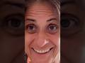 20+ Years Vegan - Dark Eye Circles From Hell #shorts