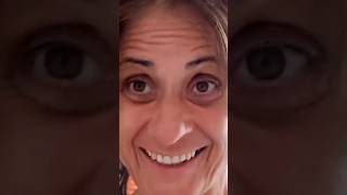 20+ Years Vegan - Dark Eye Circles From Hell #shorts