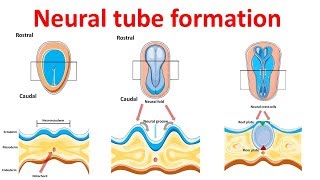 neural tube formation | Embryology - Neurulation