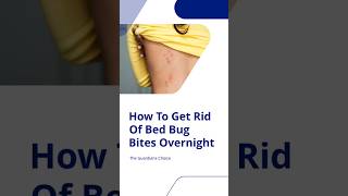 Bite Back at Bed Bugs: Overnight Relief! #shorts