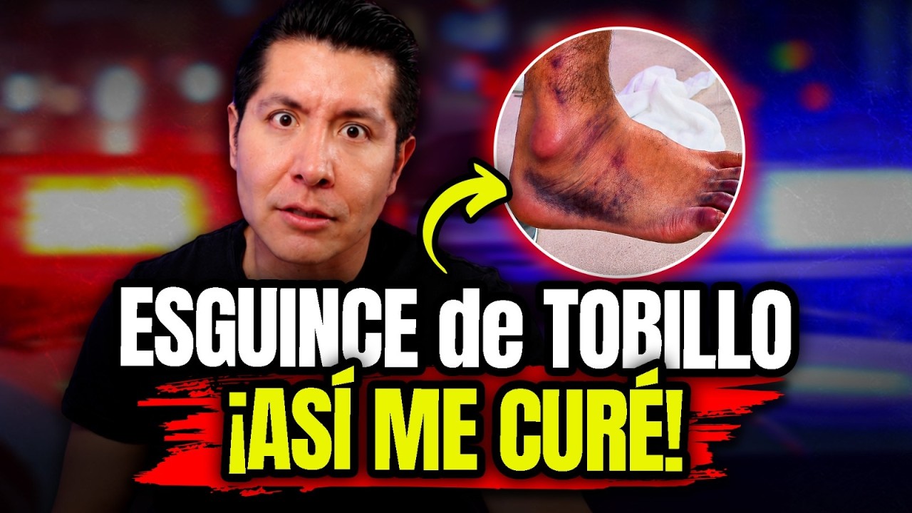 👉🏼 Me ESGUINCE el TOBILLO: ¡CASI PIERDO el PIE! ⚠️ así lo SALVÉ sin CIRUGÍA 🤯 | Mr Doctor
