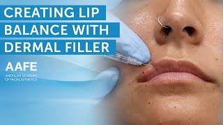 Balancing Out Lips with Top Lip Only Dermal Filler | AAFE