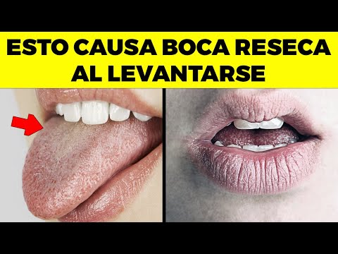 This is why you have a dry mouth when you wake up and how to cure it