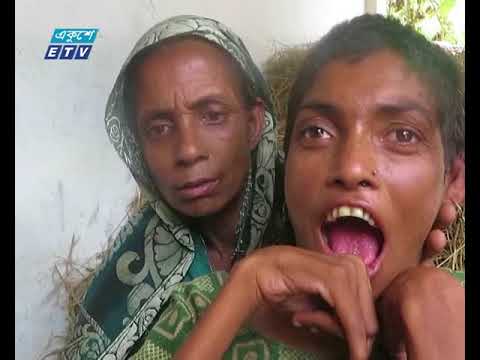 একই পরিবারের প্রতিবন্ধী চার ভাই-বোন, দুর্বিষহ জীবন