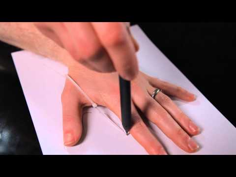 Cygnet Orthotics - Measuring Thumb Splints