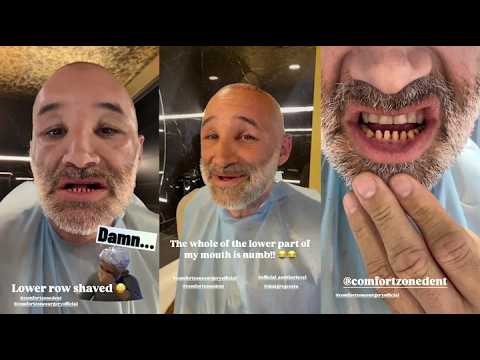 Dane Bowers Shocking Transformation: From Pop Star to Turkey Teeth