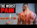 The WORST & WEIRDEST PAIN | Using FIRE To Fix Muscle Injury | Lex Fitness