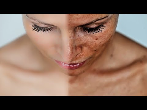 Масло персиковое для лица от пигментных пятен Отбеливание пигментные пятна