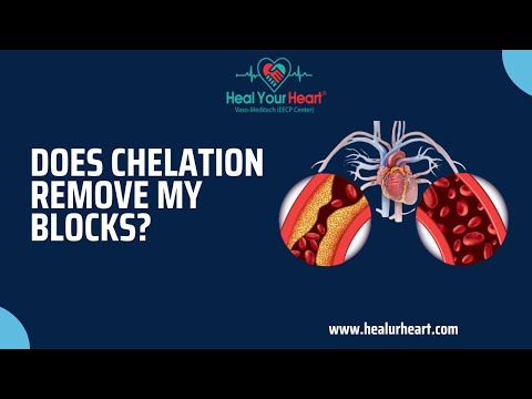 Does chelation remove my blocks?