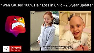 Wen Caused 100% Hair Loss in Child - 2.5 year update