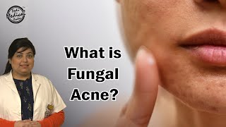 What is Fungal Acne? | How to Get Rid of Fungal Acne? | Fungal Acne Treatments | Dr. Nivedita Dadu
