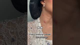 Download lagu Ada Bekas Cupang Di Leher Pengantin Wanita mp3