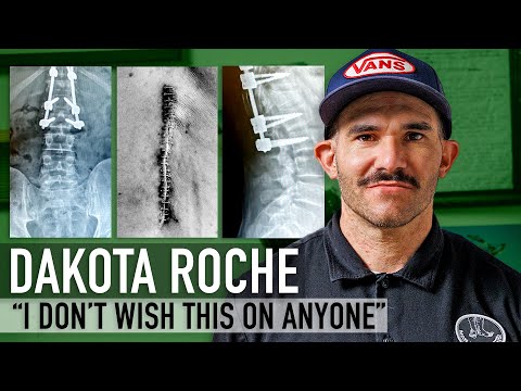 Dakota Roche on his broken back, recovery, and future - UNCLICKED
