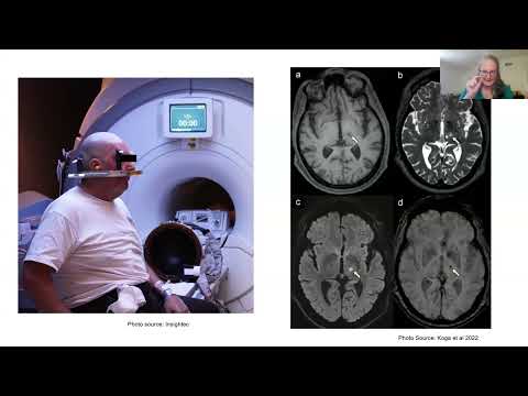 Interventional Therapies for Movement Disorders with Dr. Ferris (Stanford Univ, Dept. of Neurology)