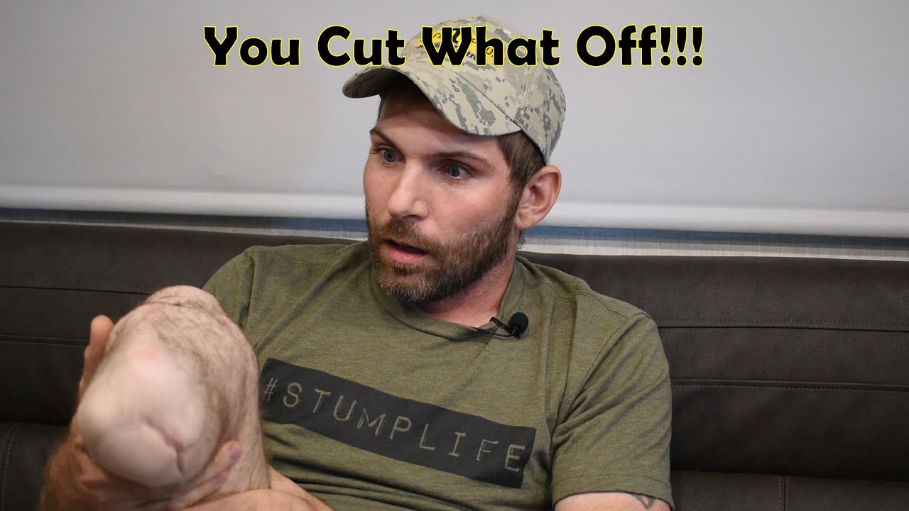 You cut what off!! My amputation Story