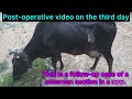 Cesarean Section L Dr Umar Khan