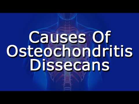 Nyaki osteochondrozis kenőzsgél