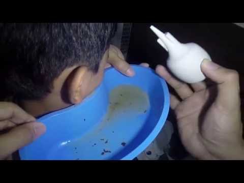 Da vermi per bambini di uno spettro largo di attività della sospensione di nome Sintomi di vermi alladulto di pyranbodies