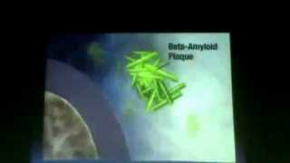 3_ Dr. Faisal - Hemoglobin Derived Pigments Extracellular Depositions Amyloidosis part 4