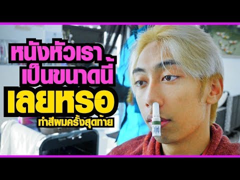 การรักษาน้ำส้มสายชูของโรคสะเก็ดเงิน ครีมกลากความคิดเห็นของนิ้วมือ