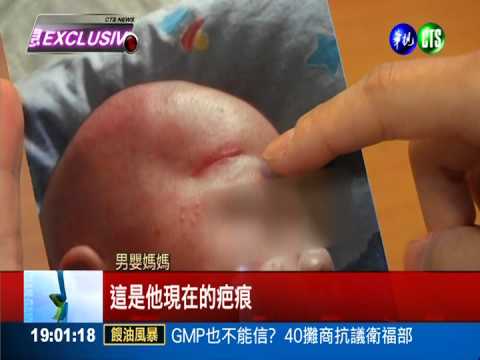 5星月子中心疏失! 燈架垮砸男嬰