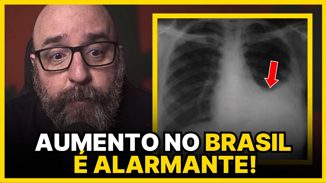 PORQUE A TUBERCULOSE AINDA É RELEVANTE NOS DIAS DE HOJE?