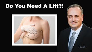 When Is A Lift Needed With Implants
