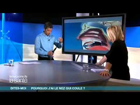 comment guerir nez qui coule