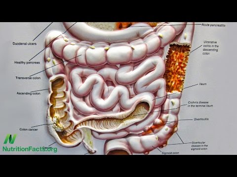 Preventing Crohn’s Disease With Diet