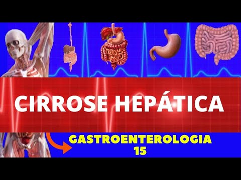 CIRROSE HEPÁTICA (CAUSAS, SINTOMAS, DIAGNÓSTICO E TRATAMENTO) - GASTROENTEROLOGIA