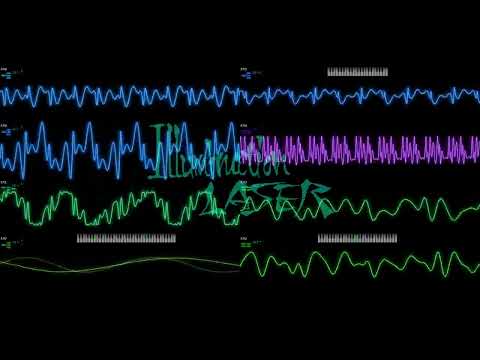 Illumination Laser - Viole`n`t Moon (Sharp X68000)