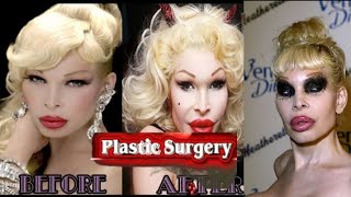 Amanda Lepore Plastic Surgery Extreme body and facial transformations.