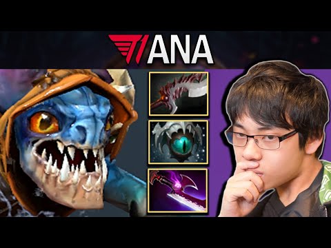 Slark Dota 2 Gameplay T1.Ana with 20 Kills and Insane Agility