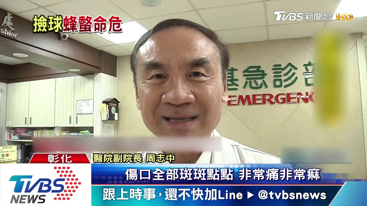 撿棒球驚動虎頭蜂 國中生遭叮咬50包