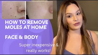 DIY Remove Moles/Freckles/Skin Tags w/Apple Cider Vinegar | Real Results Shown, Cheap & Effective!