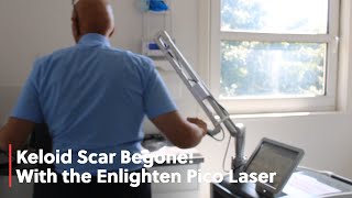 Keloid Scars Begone Only at Zenith!