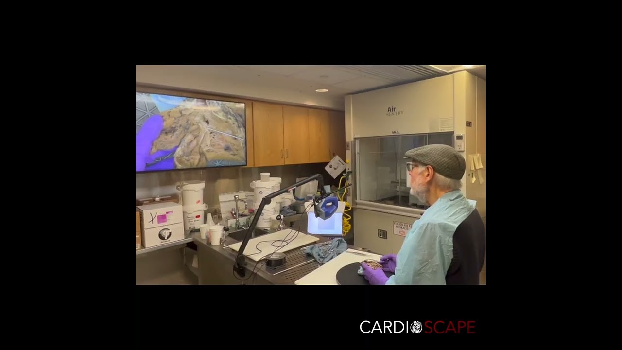 Explore & Download for FREE Now! www.LearnCHD.com #pediatriccardiology #chdawareness #anatomy