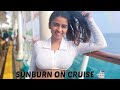 SUNBURN ON CRUISE Suhana Khan
