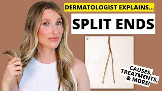 Split Ends: Dermatologist Explains Damaged Hair Causes, Treatments, Prevention, &amp; More!