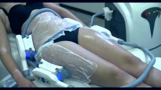 Miniature de la vidéo