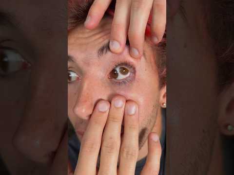 Algo MUY RARO me pasó en el ojo😱👁️🤯