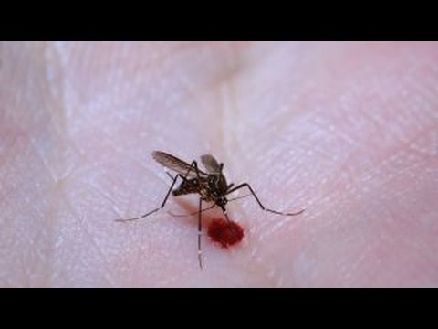 Homegrown Zika, obesity brain risk, book lovers live longer