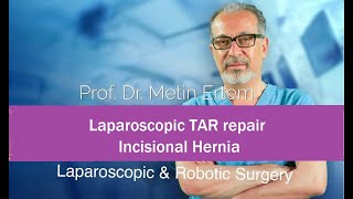 Miniaturka - Laparoscopic TAR Repair. Incisional Hernia. Metin ertem. MD FACS.