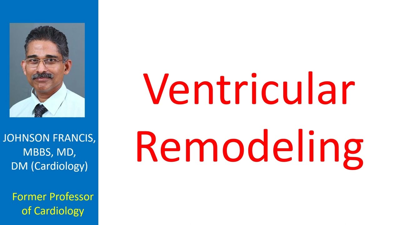 Ventricular Remodeling