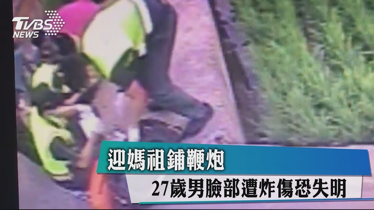 迎媽祖鋪鞭炮 27歲男臉部遭炸傷恐失明