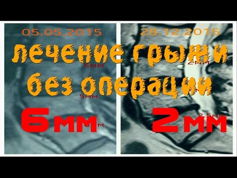 Боли в суставах снятие боли Болят мышцы шеи из за чего