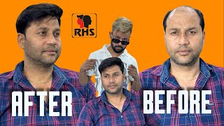 Hair Patch For Men | Hair Clip system |