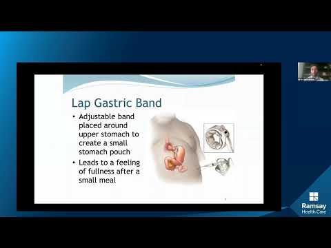 Bariatrics Weight Loss Webinar - Peninsula Private Hospital video thumbnail