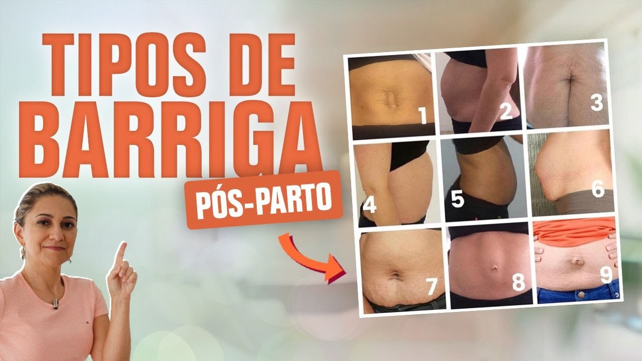 5 Tipos de Barriga Pós-Parto: Conheça Todos os Tipos de Barriga e O Que Fazer Para Voltar ao Normal